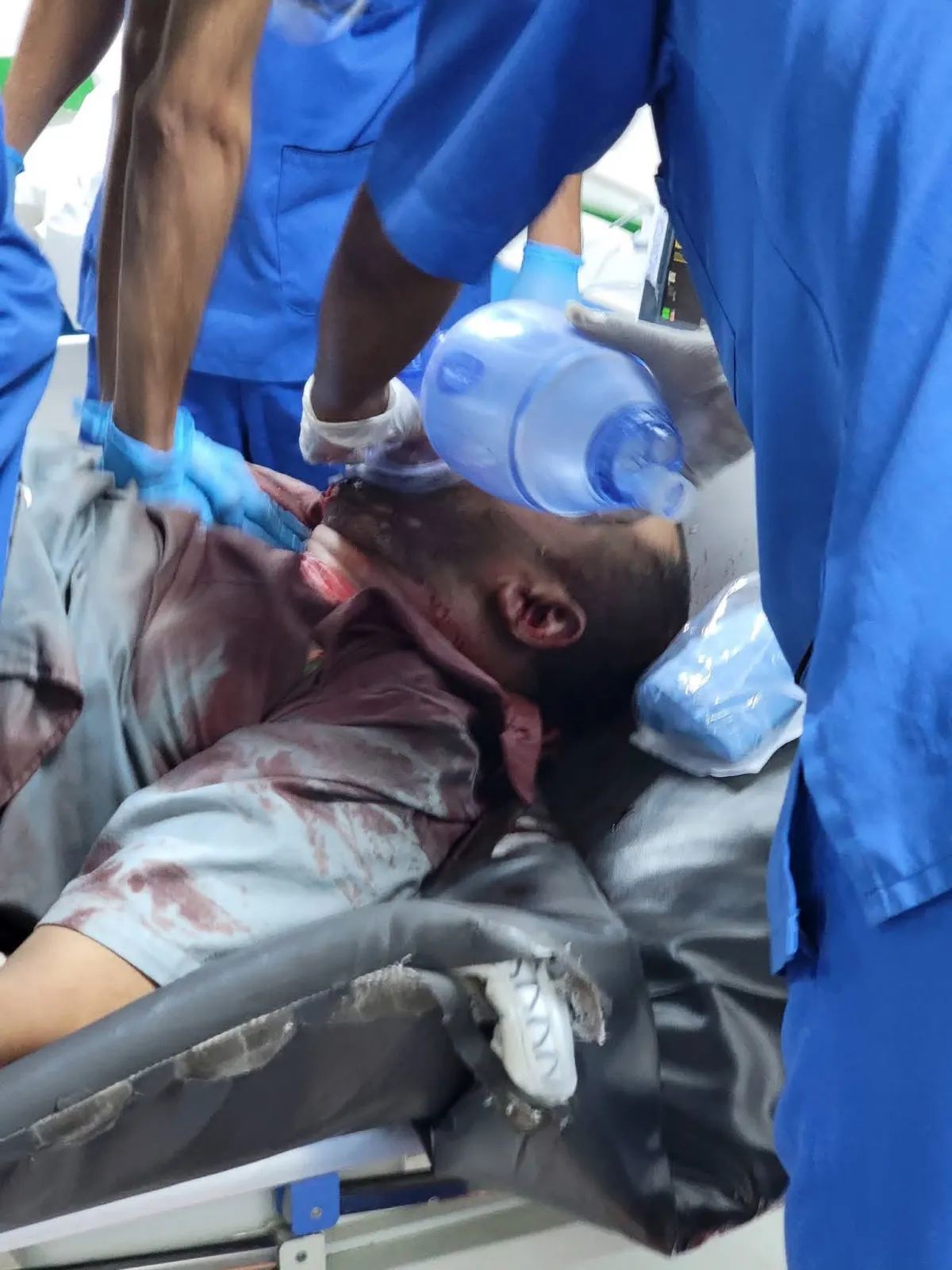 سقوط جرحى خلال اقتحام متظاهرين لمبنى السلطة المحلية في محافظة شبوة